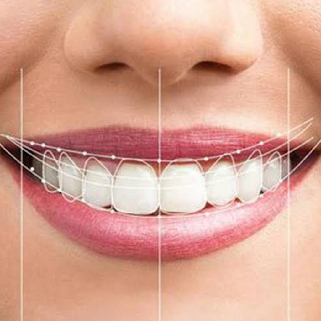 Periodontal Treatment
