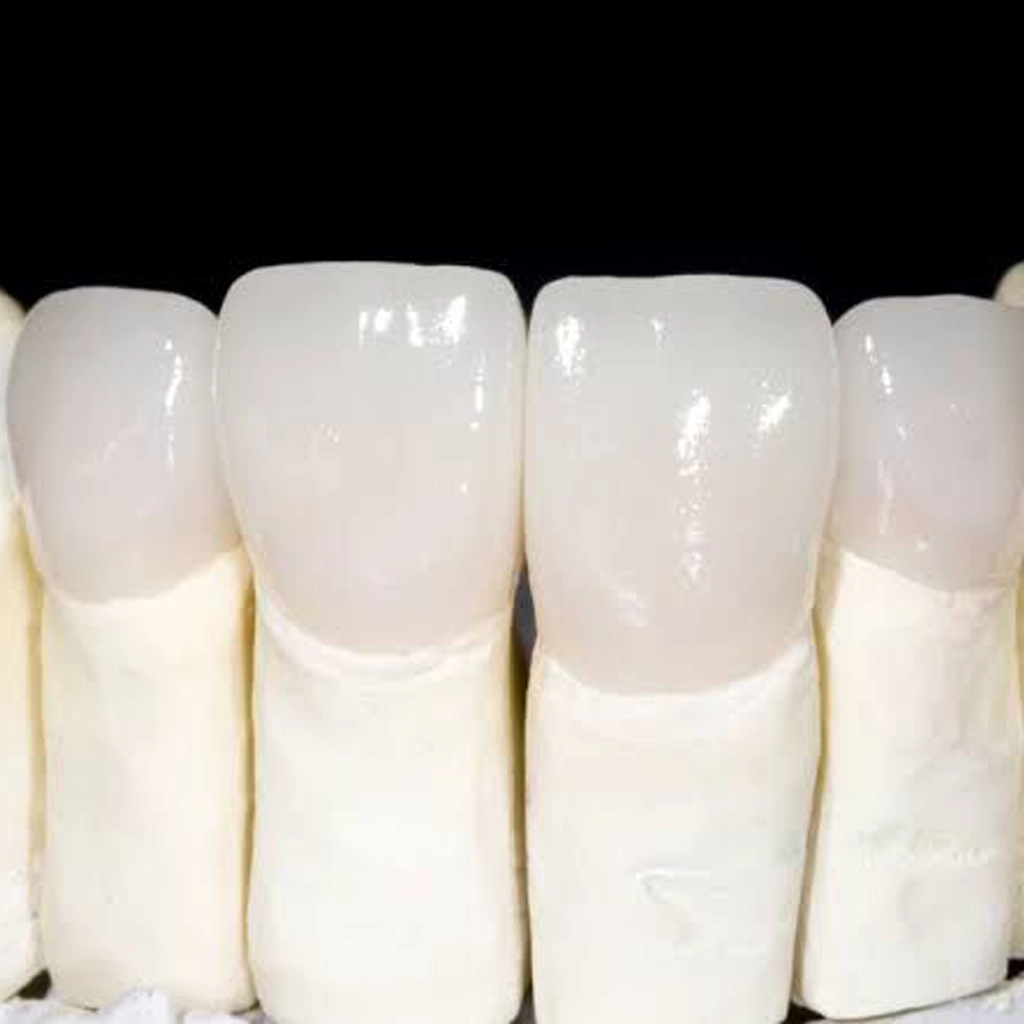 Dental Implant